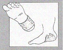 MEDICAZIONE ASSORBENTE IN POLIURETANO ESPANSO LIGASANO STRUTTURA A NIDO D'APE NON STERILE 15X15CM ALTEZZA 1CM 10 PEZZI